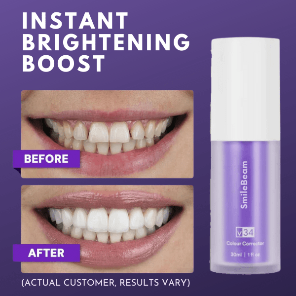 SmileBeam™ Color Corrector Serum