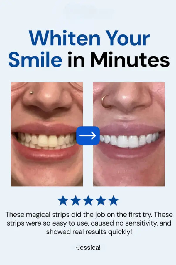 SmileBeam™ Wireless Teeth Whitening Kit