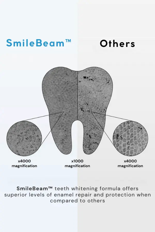 SmileBeam™ Wireless Teeth Whitening Kit